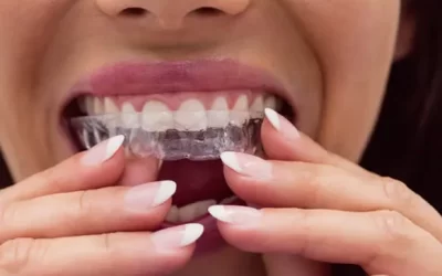 Invisalign Memphis: Clear Aligner Therapy for Discreet Orthodontic Correction